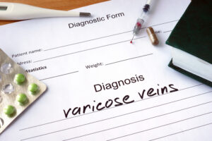 Varicose veins diagnosis