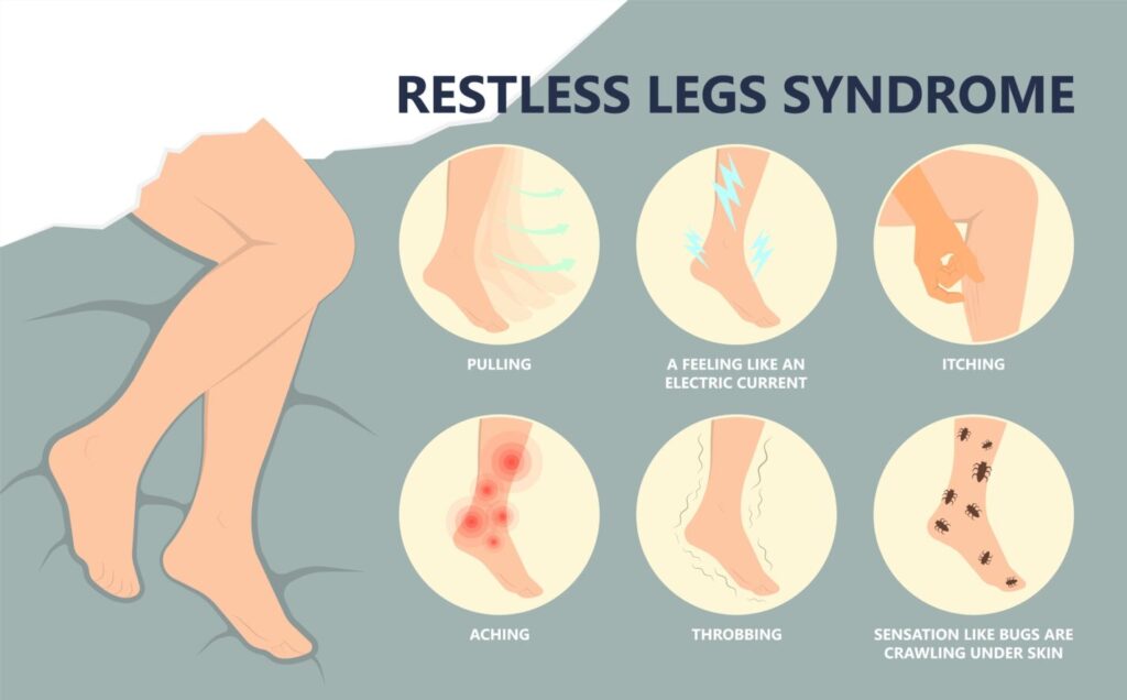Restless leg syndrome diagram